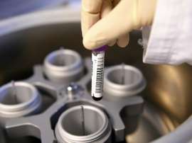 At least four Cypriot clubs are believed to have given players 'unidentified substances'. AFP