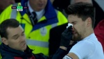 Le partieron la nariz celebrando el gol de Mawson al Liverpool