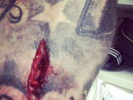 El jugador del West Brom James McClean muestra la herida de su pierna. Jimmymac